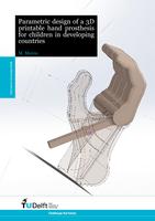 Parametric design of a 3D printable hand prosthesis for children in developing countries