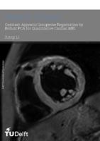 Contrast-agnostic groupwise registration by robust PCA for quantitative cardiac MRI