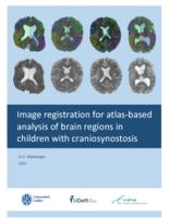 Image registration for atlas-based analysis of brain regions in children with craniosynostosis