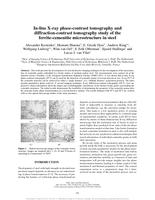 In-line x-ray phase-contrast tomography and diffraction-contrast tomography study of the ferrite-cementite microstructure in steel