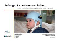 Redesign of a redressement helmet for non-synostotic deformational plagiocephaly and brachycephaly