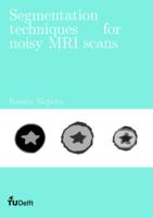 Segmentation techniques for noisy MRI scans