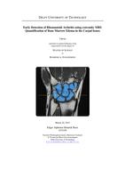 Early Detection of Rheumatoid Arthritis using extremity MRI: Quantification of Bone Marrow Edema in the Carpal bones