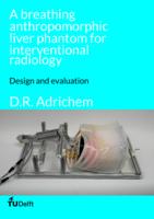 A breathing anthropomorphic liver phantom for interventional radiology
