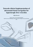 Towards clinical implementation of ultrasound-based navigation for laparoscopic liver resection