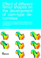 Effect of different femur shapes on the development of cam-type deformities