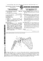 Joint prosthesis and method of bone fixation