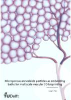 Microporous annealable particles as embedding baths for multiscale vascular 3D bioprinting