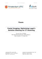 Foetal Imaging: Optimising Lugol’s Solution Staining for CT Scanning