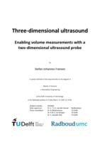 Three-dimensional ultrasound