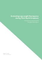 Evaluating Leg Length Discrepancy during Total Hip Arthroplasty