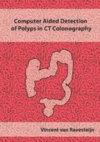 Computer Aided Detection of Polyps in CT Colonography