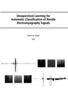 Unsupervised Learning for Automatic Classification of Needle Electromyography Signals